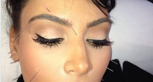 Kim Kardashian undergoes another beauty procedure