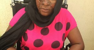 Ini Edo acid attack face