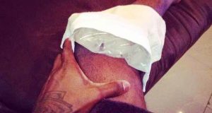 Peter Okoye shows off 'bandaged' leg after his fall