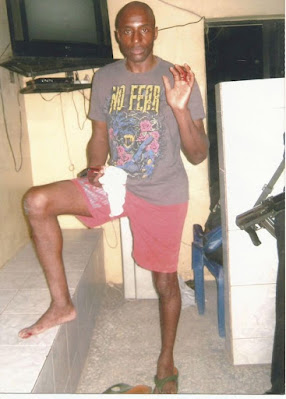 Photo in police files of Fashanu with a cut hand after alleged attacks