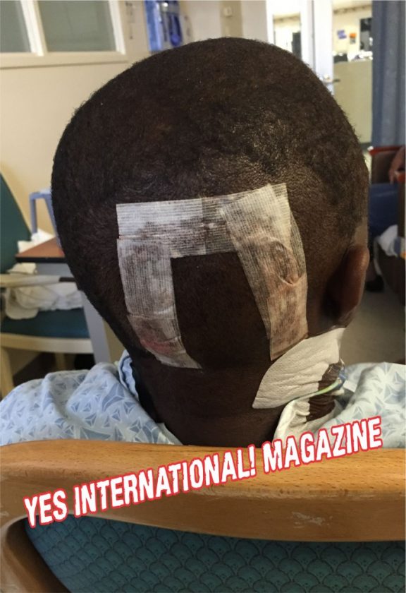 Julius Agwu head surgery