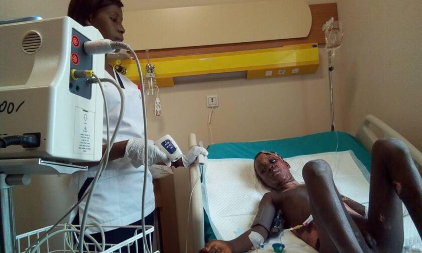 Mobile phone thieves set 12-year-old boy ablaze in Kogi