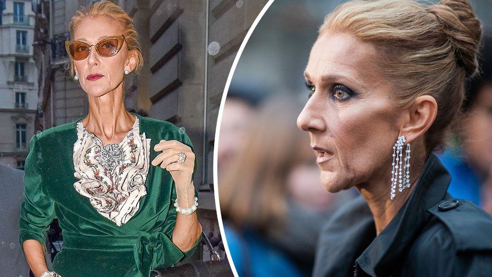It'll Take A While Before Celine Dion Returns To The Stage - Sister 1 Celine Dion