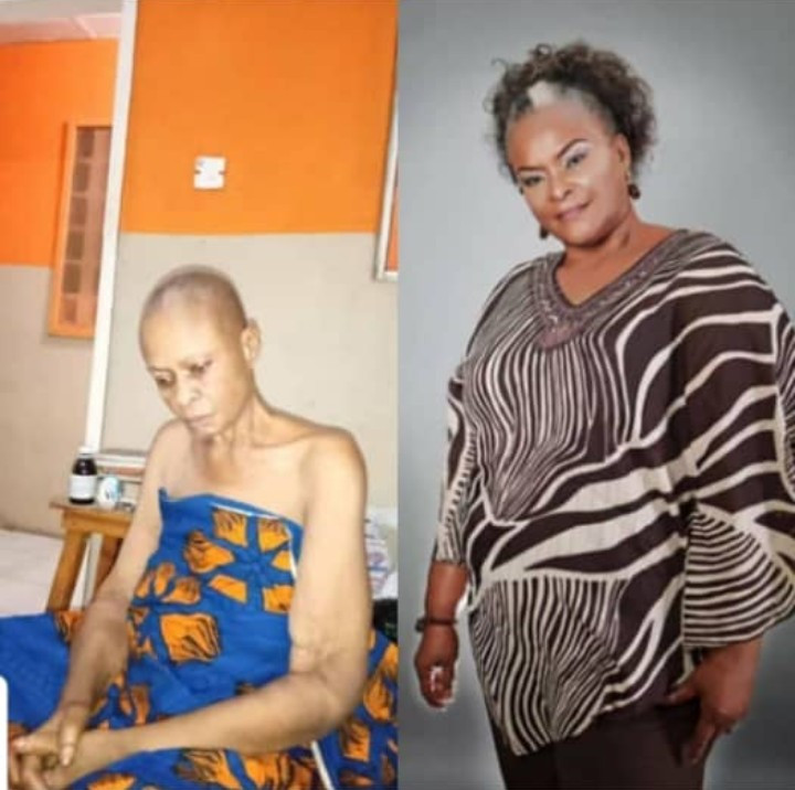 Cancer Is Killing Me, Nigerians Should Please Come To My Rescue - Ify Onwuemene 1 Ify Onwuemene