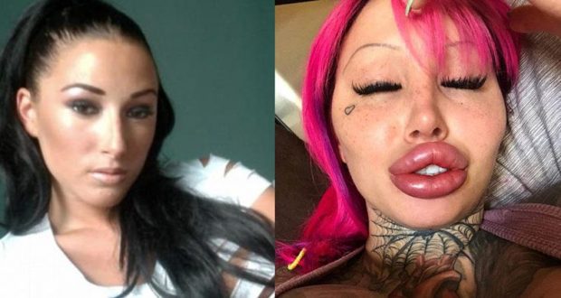 mary magdalene plastic surgery addict before Image 4